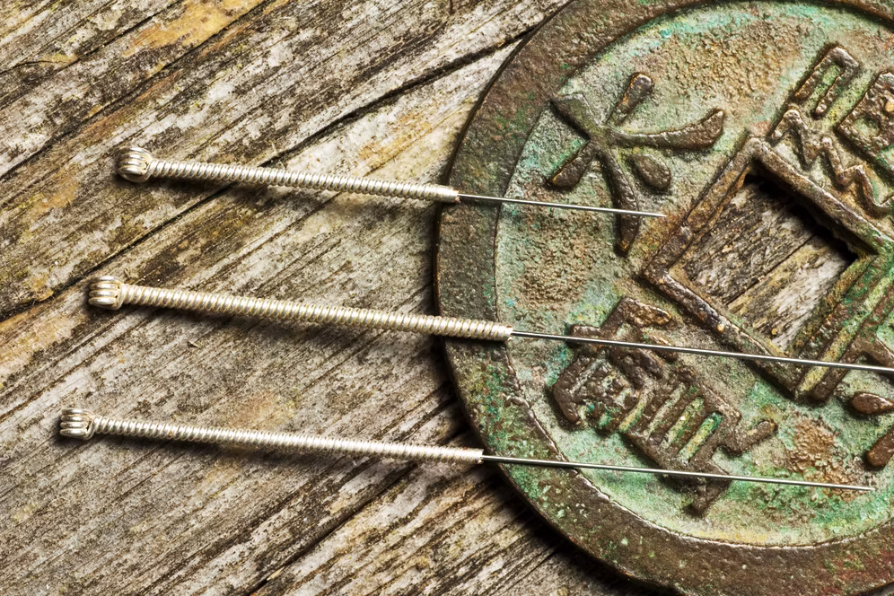 Traditional Chinese coin with acupuncture needles.